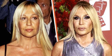 donatella versace before plastic|Donatella Versace facelift.